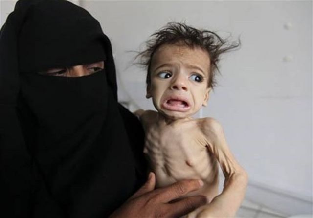 هشدار یونیسف درباره تمام‌شدن سوخت و واکسن در یمن