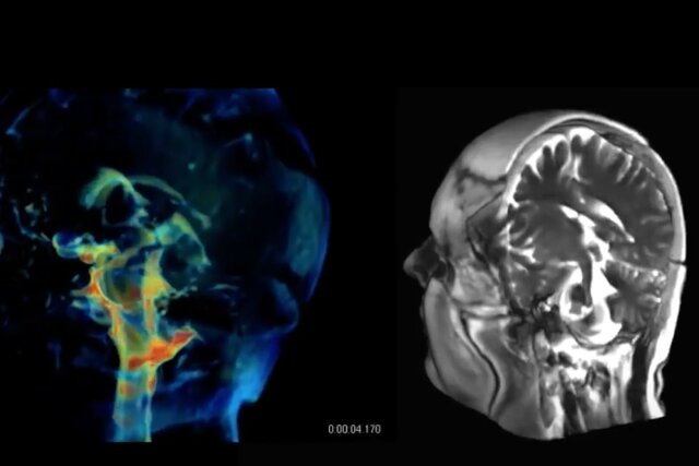 فناوری جدیدی برای تصویربرداری ۳ بعدی از مغز|شهرکریمه