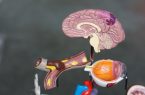 کشف ساختار هایی که به مقابله با تومور های مغزی کمک می‌ کند|شهرکریمه