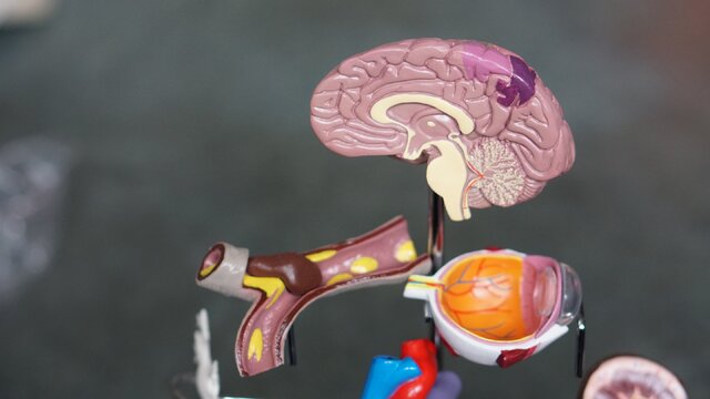 کشف ساختار هایی که به مقابله با تومور های مغزی کمک می‌ کند|شهرکریمه